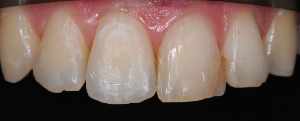 Gydytojos odontologės, estetinių restauracijų specialistės, Ingos Linkytės-Šližienės atvejis prieš