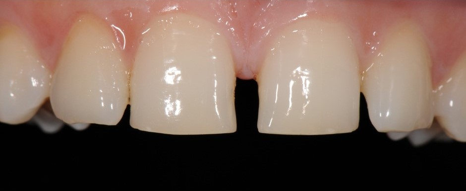 Gydytojo odontologo-ortopedo Dariaus Kunčiaus atvejis prieš