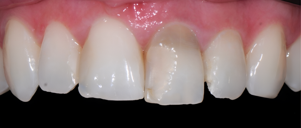 Gydytojo odontologo, estetinių restauracijų specialisto, Žilvino Budrevičiaus atvejis prieš