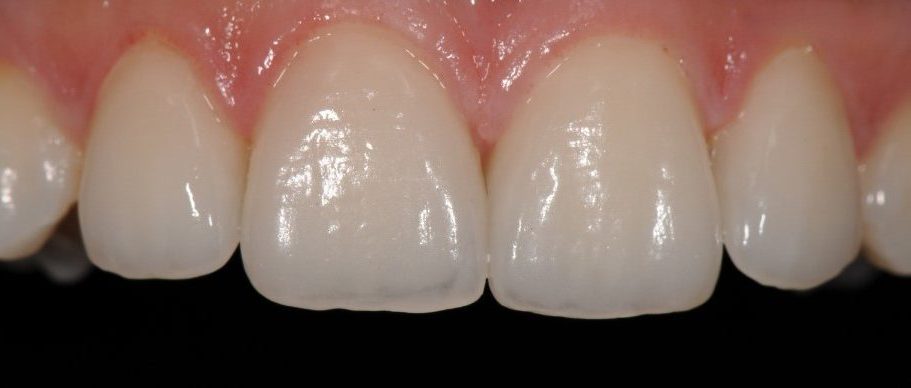 Gydytojo odontologo-ortopedo Dariaus Kunčiaus atvejis po