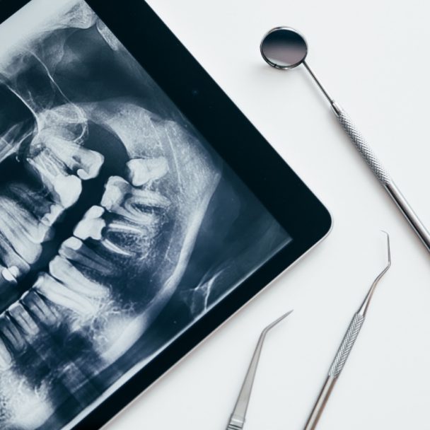 Panoraminio rentgenologinio tyrimo analizė