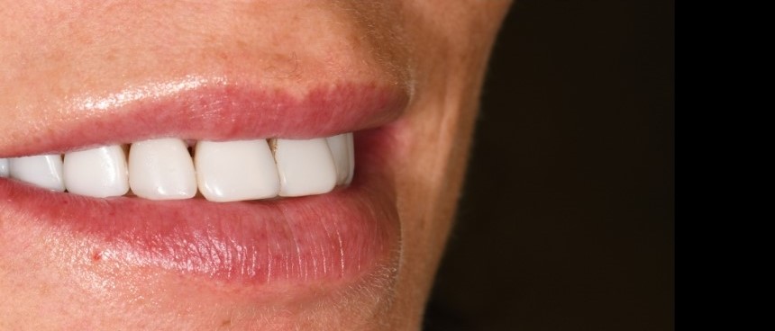 Gydytojo odontologo, estetinių restauracijų specialisto, Žilvino Budrevičiaus atvejis prieš