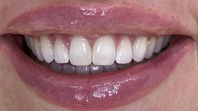 Burnos higienistės Justės Kunčiuvienės atvejis po