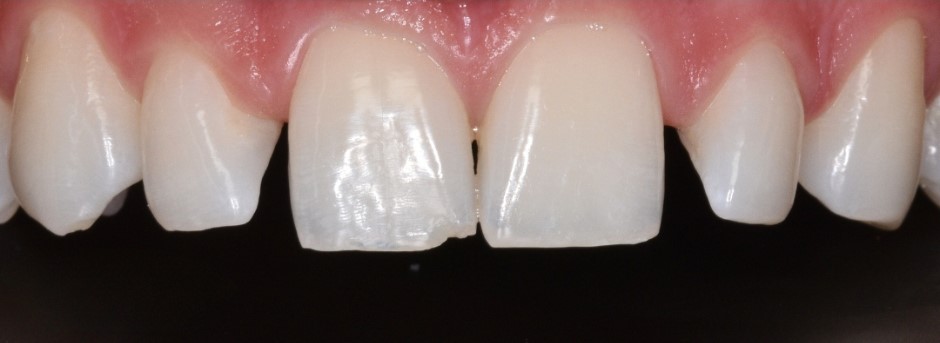 Gydytojos odontologės, estetinių restauracijų specialistės, Odetos Bardijevskienės atvejis prieš