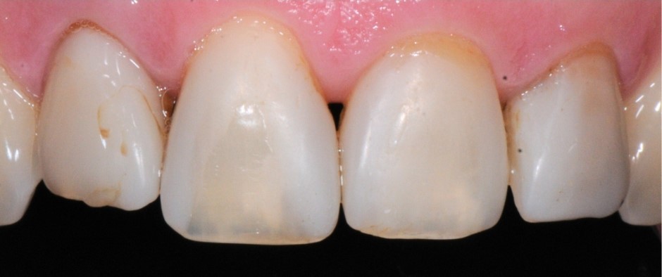 Gydytojos odontologės, estetinių restauracijų specialistės, Ingos Linkytės-Šližienės atvejis prieš