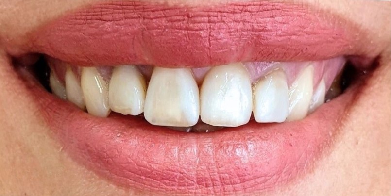 Gydytojos odontologės, estetinių restauracijų specialistės, Ingos Linkytės-Sližienės atvejis prieš