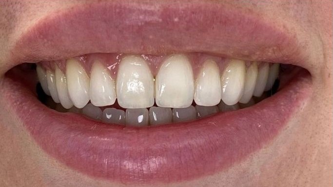 Burnos higienistės Justės Kunčiuvienės atvejis prieš