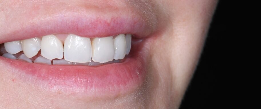 Gydytojo odontologo, estetinių restauracijų specialisto, Žilvino Budrevičiaus atvejis prieš