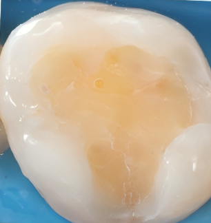 Gydytojos odontologės Viltės Gabalytės atvejis prieš