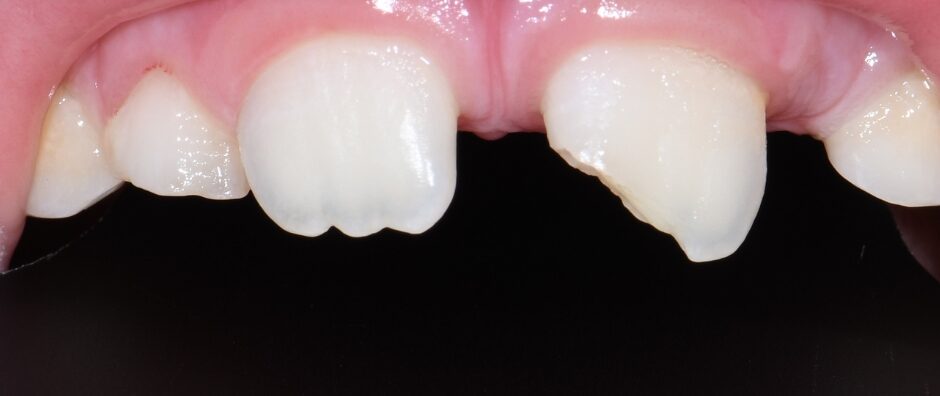 Gydytojo odontologo, estetinių restauracijų specialisto, Žilvino Budrevičiaus atvejis prieš