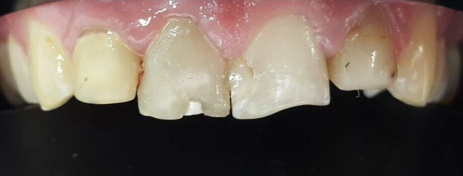 Gydytojos odontologės, estetinių restauracijų specialistės, Ingos Linkytės-Sližienės atvejis prieš