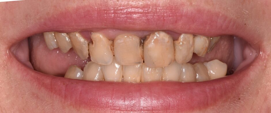 Gydytojo odontologo Justino Bardijevskio „Neoarch” gydymo atvejis prieš