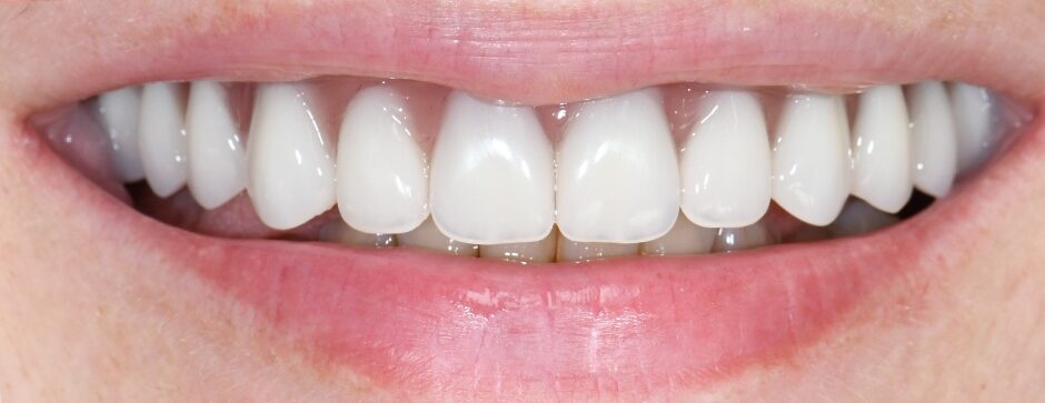 Gydytojo odontologo Justino Bardijevskio „Neoarch” gydymo atvejis po