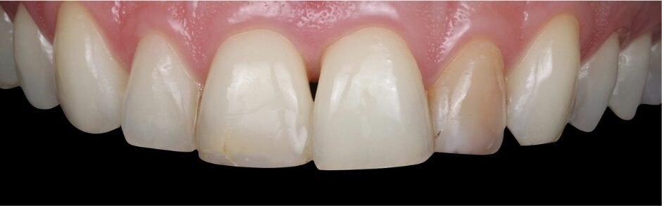 Gydytojos odontologės Viltės Gabalytės atvejis prieš