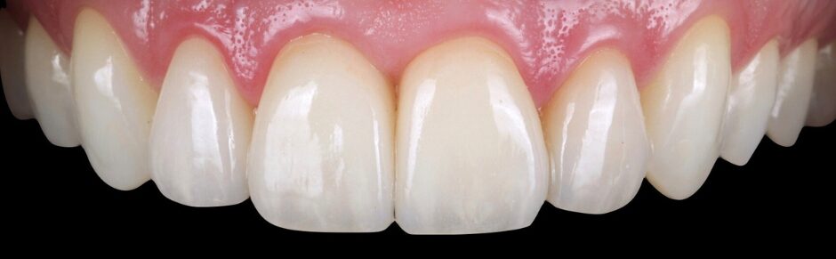 Gydytojos odontologės Viltės Gabalytės atvejis po