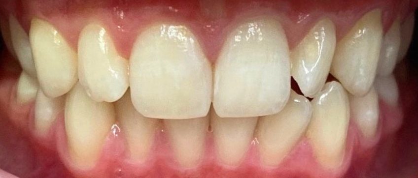 Dantų tiesinimo kapomis specialistės, gydytojos odontologės Viktorijos Šimkutės atvejis prieš