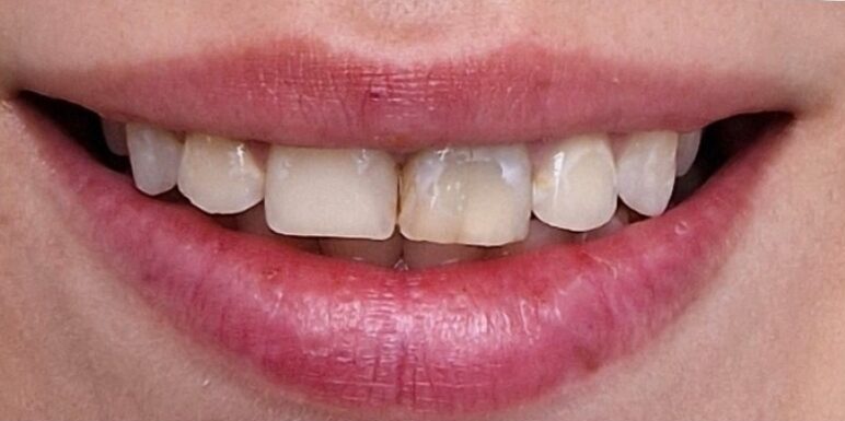 Gydytojos odontologės, estetinių restauracijų specialistės, Ingos Linkytės-Sližienės atvejis prieš