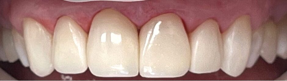 Gydytojos odontologės Gabrielės Baršauskaitės atvejis po