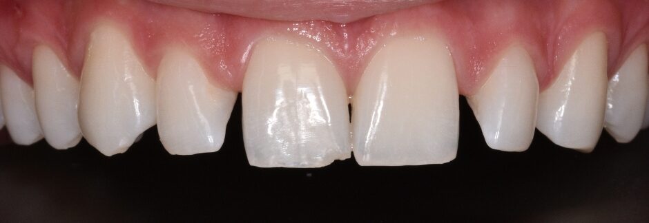 Gydytojo odontologo, estetinių restauracijų specialistės, Odetos Bardijevskienės atvejis prieš