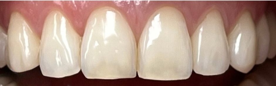 Burnos higienistės Kamilės Kazlauskaitės dantų balinimo Philips ZOOM sistema atvejis prieš