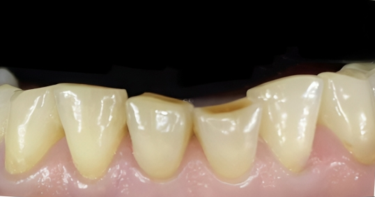 Gydytojo odontologo, estetinių restauracijų specialistės, Odetos Bardijevskienės atvejis prieš