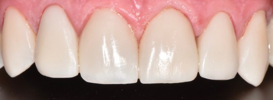 Gydytojos odontologės Gabrielės Baršauskaitės atvejis po