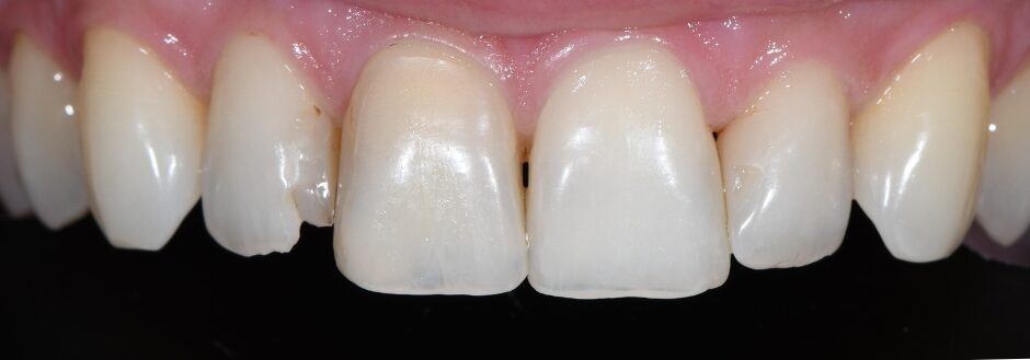 Gydytojo odontologo, estetinių restauracijų specialisto, Žilvino Budrevičiaus atvejis prieš