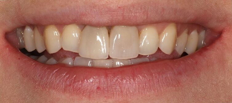 Gydytojos odontologės Viltės Gabalytės atvejis prieš