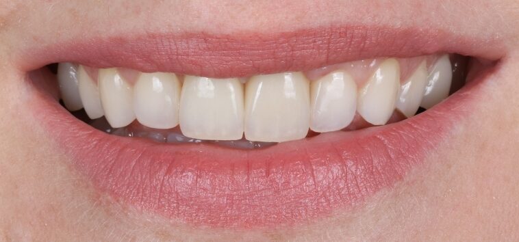 Gydytojos odontologės Viltės Gabalytės atvejis po