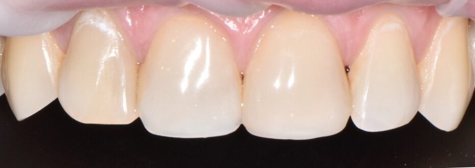 Gydytojos odontologės Gabrielės Baršauskaitės atvejis prieš