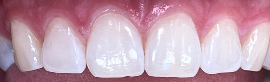 Burnos higienistės Julijos Ūlos Petniūnaitės atvejis po