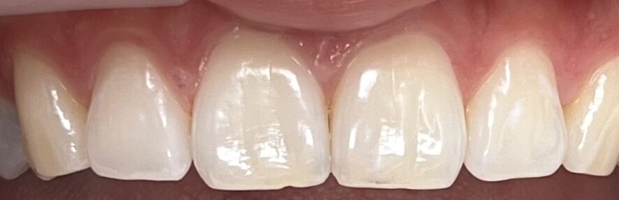 Burnos higienistės Julijos Ūlos Petniūnaitės atvejis prieš