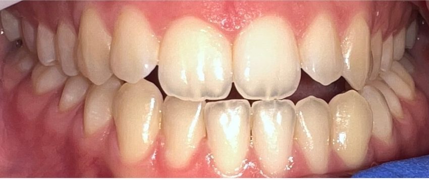 Dantų tiesinimo kapomis specialistės, gydytojos odontologės Viktorijos Šimkutės atvejis prieš