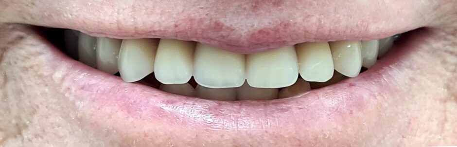 Gydytojos odontologės ortopedės Rūtos Krušinskaitės atvejis po