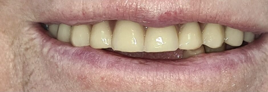 Gydytojos odontologės ortopedės Rūtos Krušinskaitės atvejis prieš