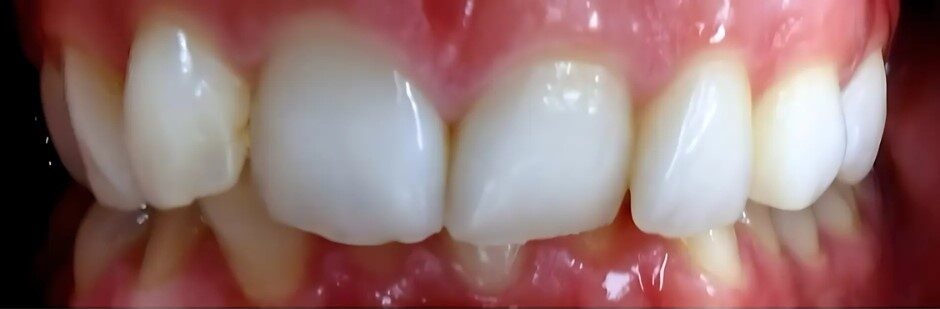 Gydytojos ortodontės Ievos Laktionkinienės ortodontinio gydymo atvejis prieš