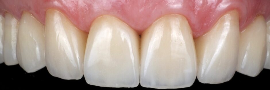 Gydytojos odontologės Viltės Gabalytės atvejis po