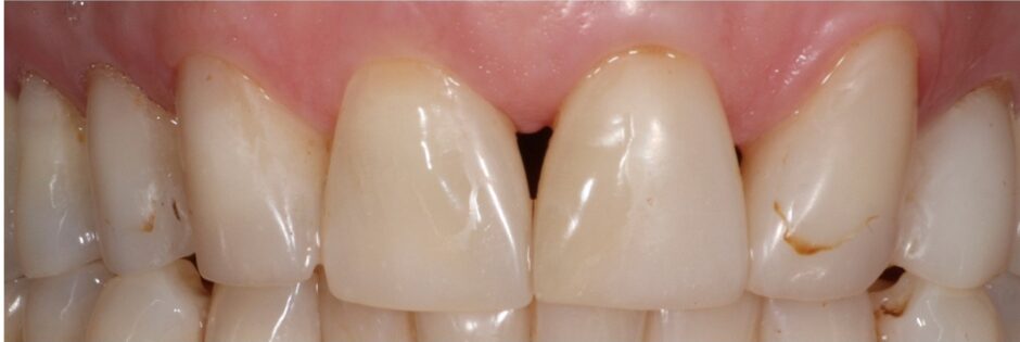 Gydytojos odontologės Viltės Gabalytės atvejis prieš