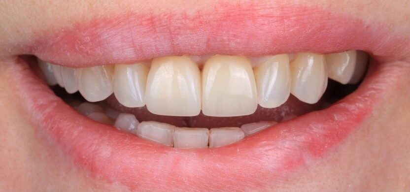 Gydytojos odontologės Viltės Gabalytės atvejis po