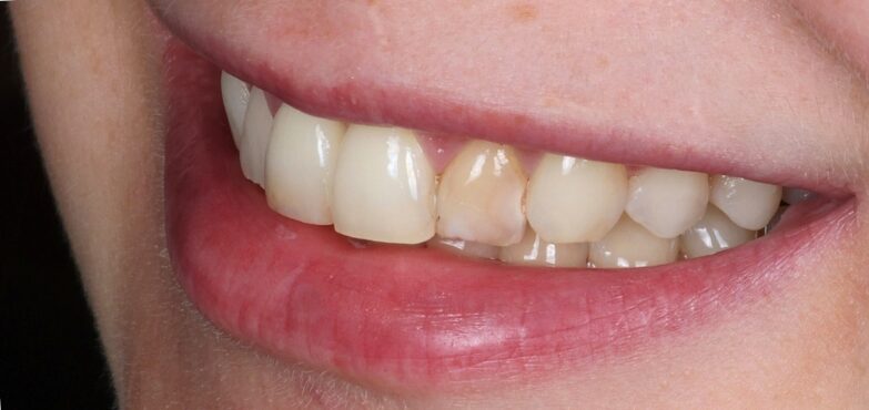 Gydytojos odontologės Viltės Gabalytės atvejis prieš