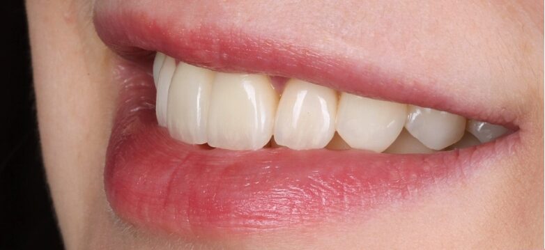 Gydytojos odontologės Viltės Gabalytės atvejis po