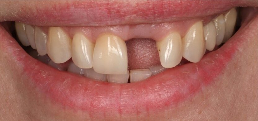 Gydytojos odontologės Viltės Gabalytės atvejis prieš